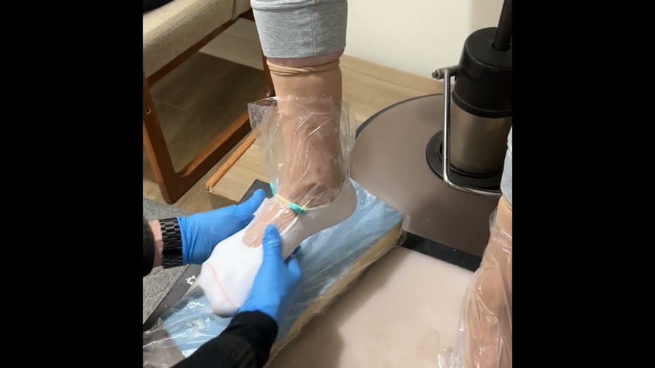 Casting for custom shoes using the STS slipper socks