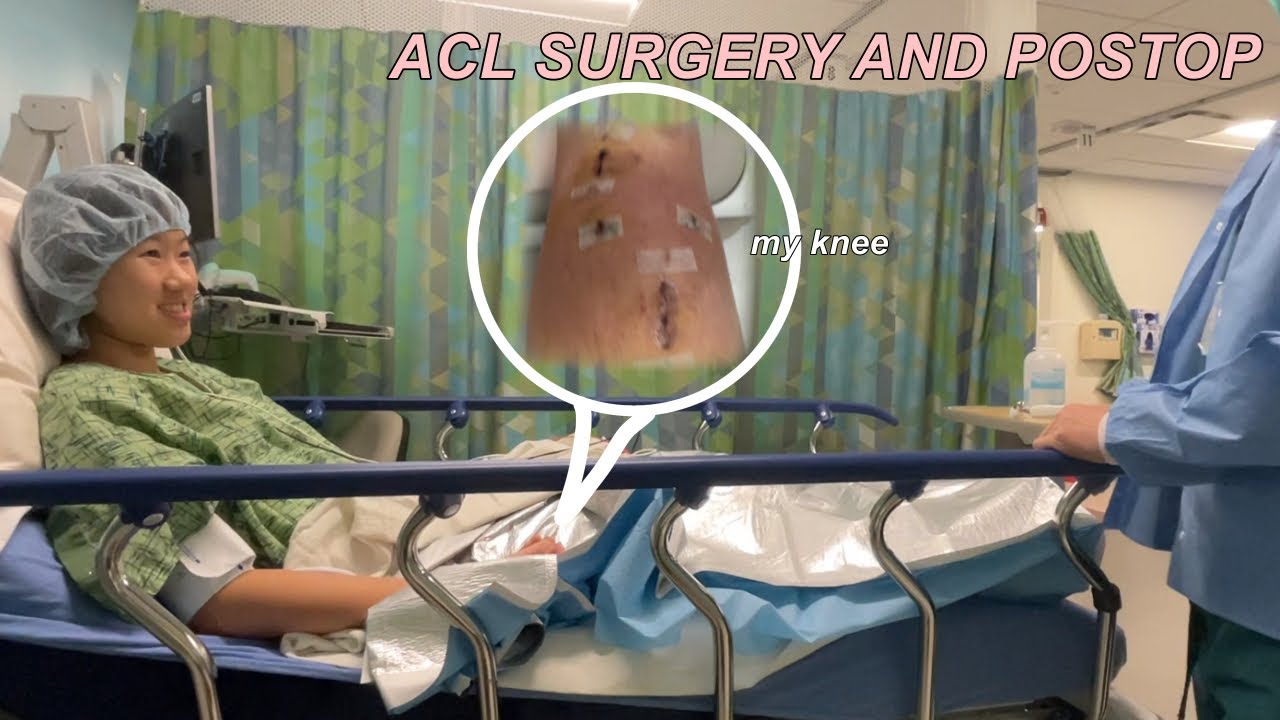 ACL Surgery [Week 1 Post-op Vlog]