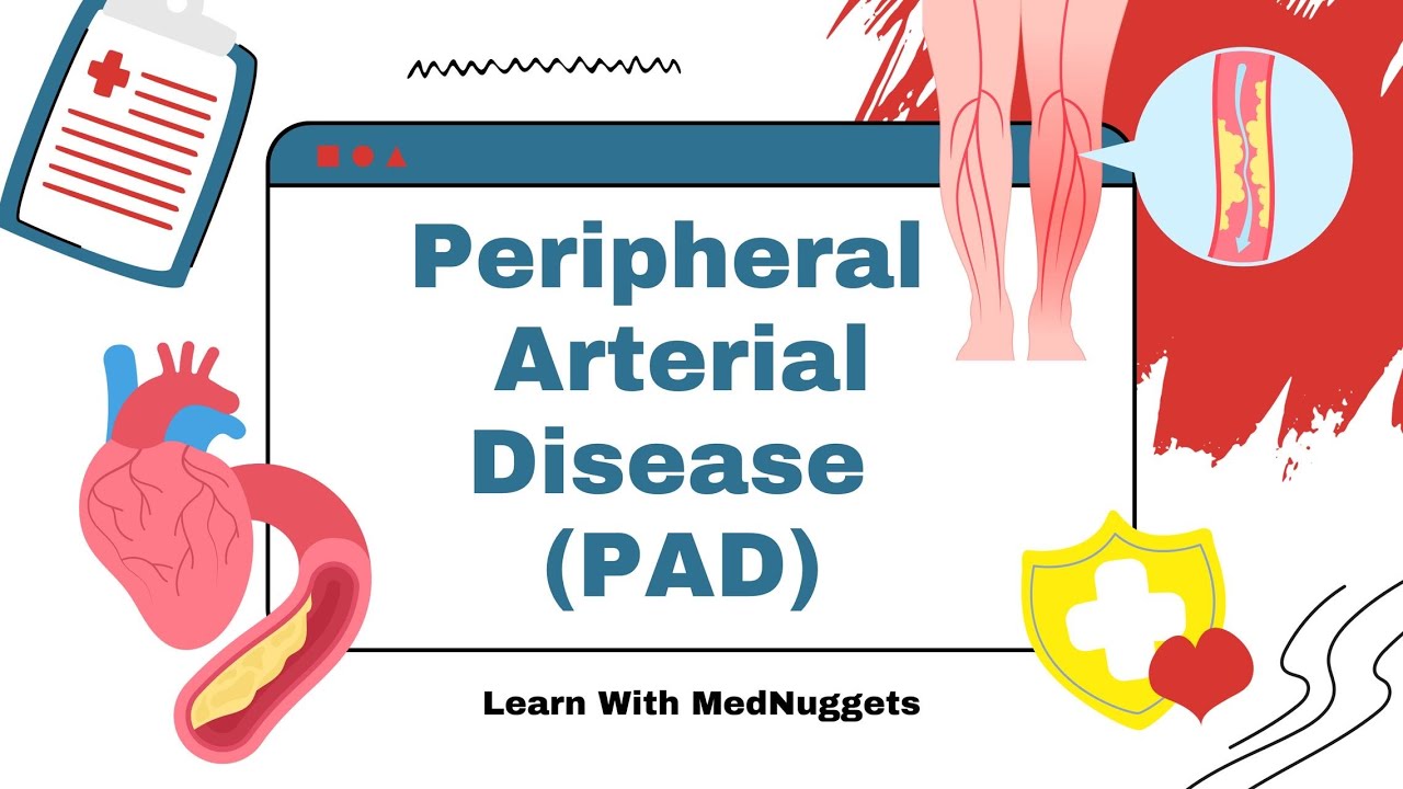 Peripheral Arterial Disease (PAD)
