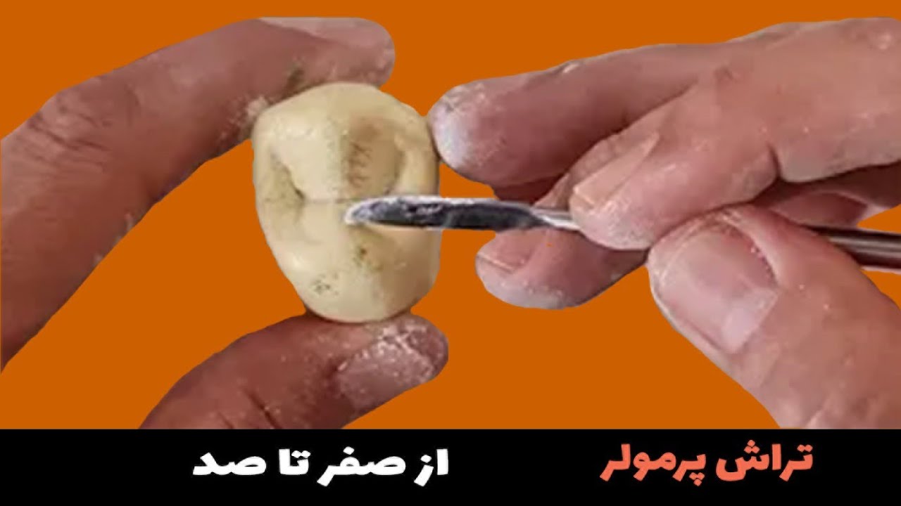 تراش اولیه دندان پرمولر اول با گچ مورفولوژی