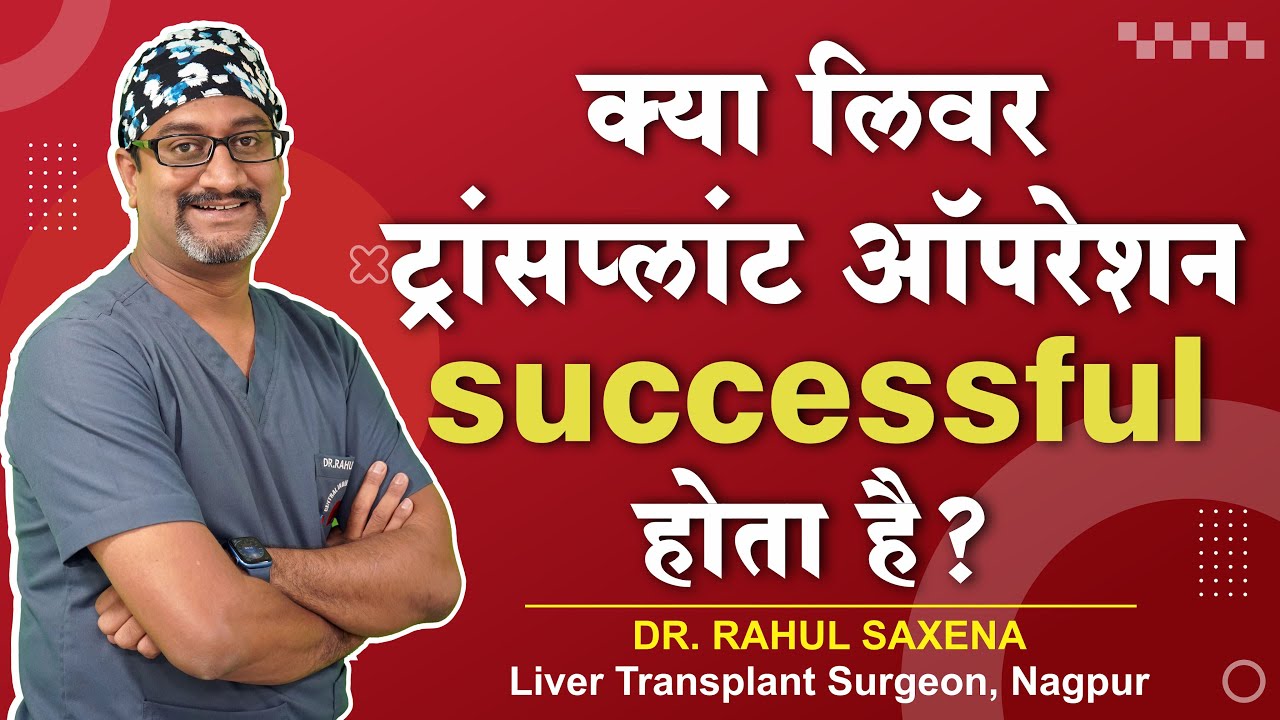 क्या लिवर ट्रांसप्लांट ऑपेरशन Successful होता है? Dr. Rahul Saxena-Liver Transplant Surgeon