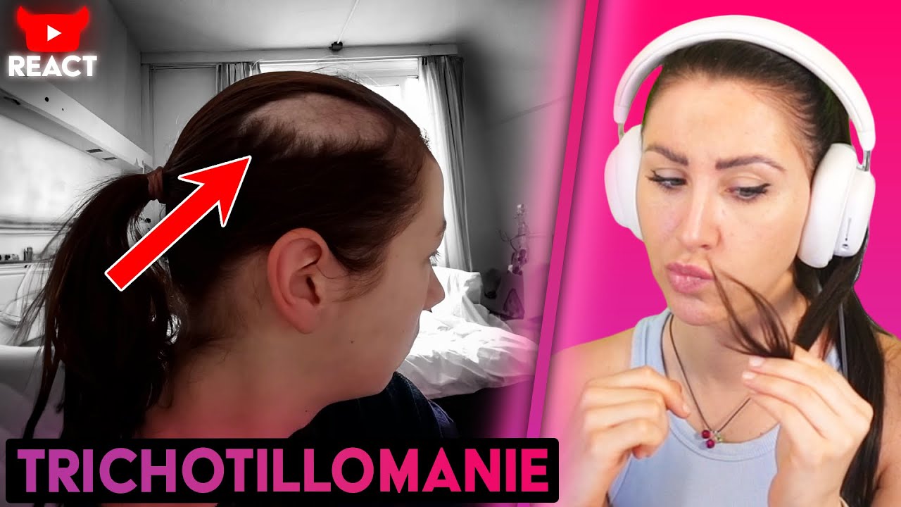 Haare aus Zwang ausreißen! Ich hatte das auch…