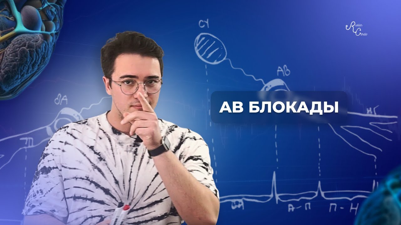 Атриовентрикулярные блокады