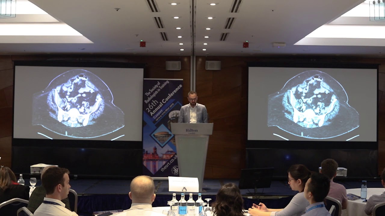 Radiology Rewind: SRT 2019 - ‘Discrepancies in Radiology’ by Dr James Stephenson