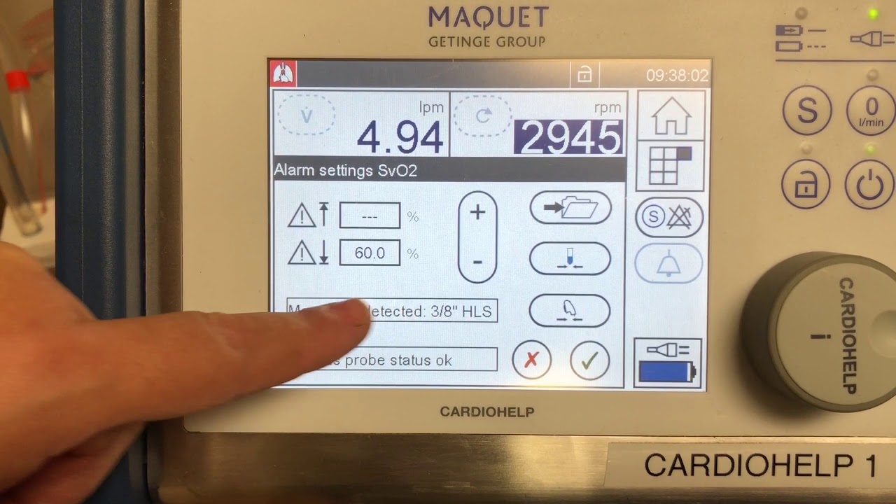 Venous Probe Calibration