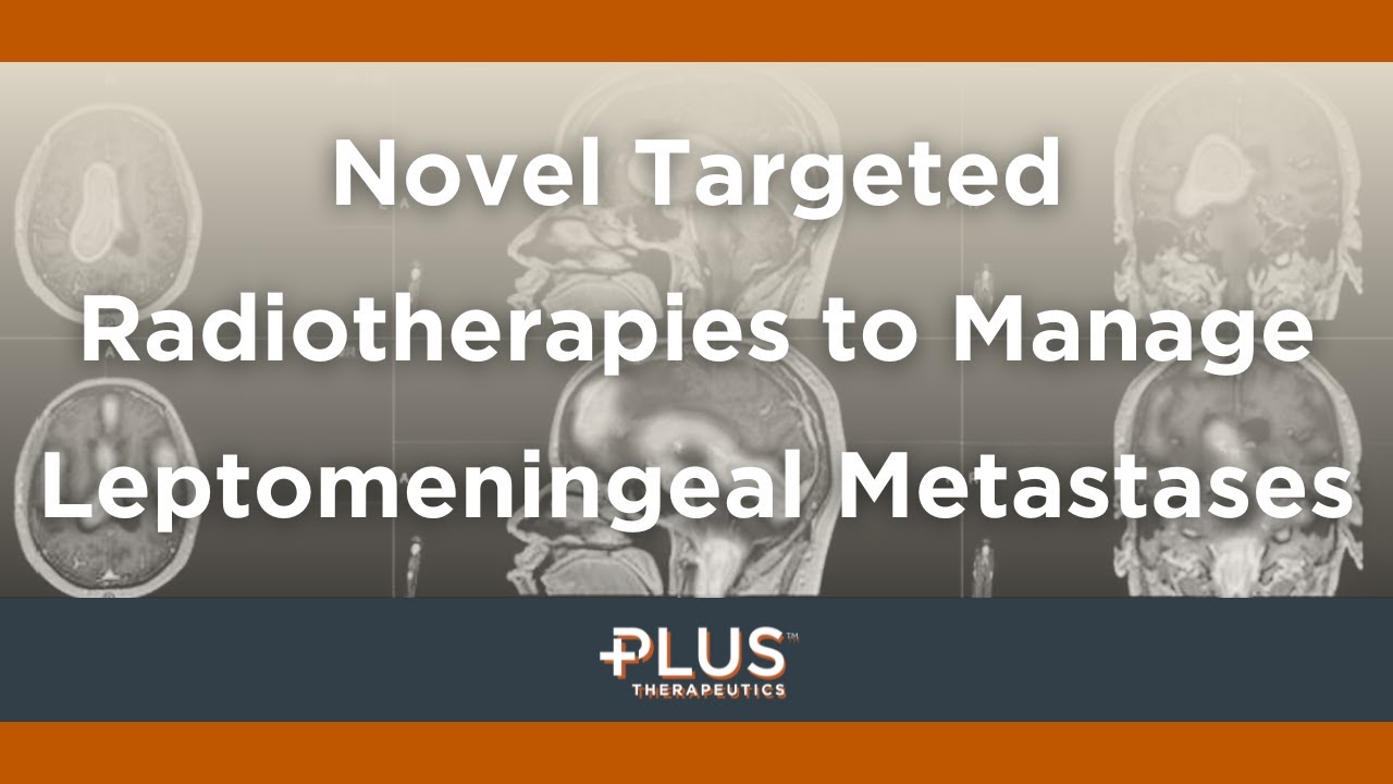 Novel Targeted Radiotherapies to Manage Leptomeningeal Metastases