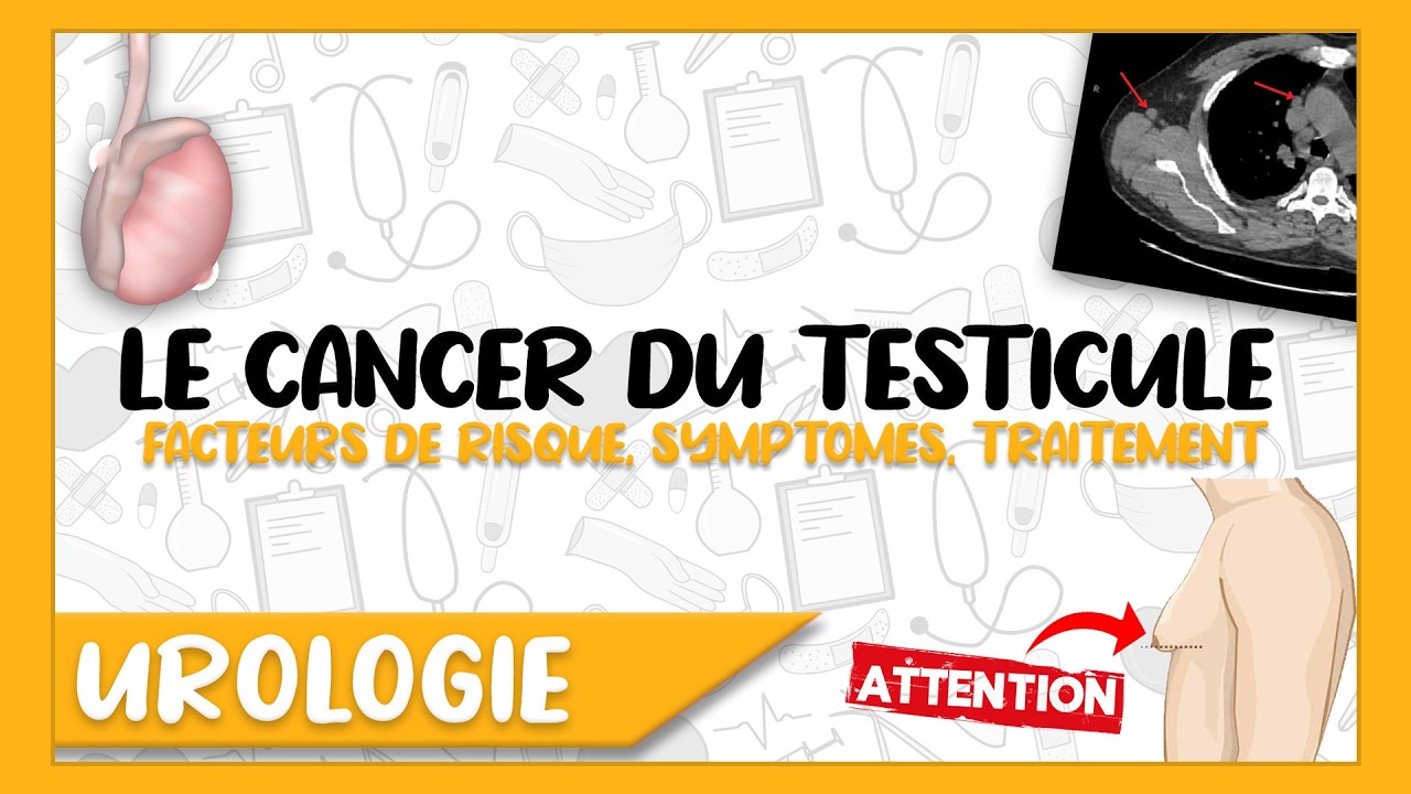 LE CANCER DU TESTICULE: Facteurs de risque, Diagnostic Positif et Différentienl et Traitement