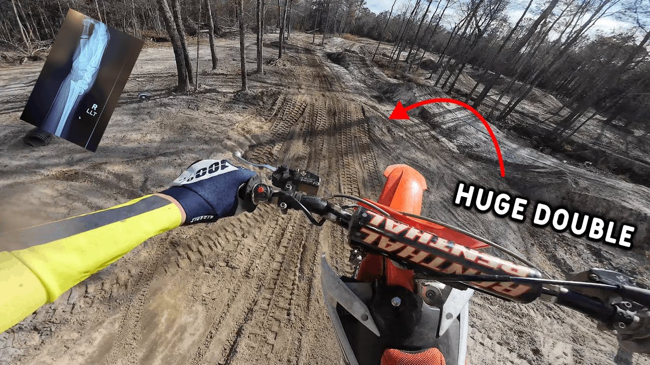 FIRST RIDE BACK After Injury! - KTM 85 Laps at Private Motocross Track