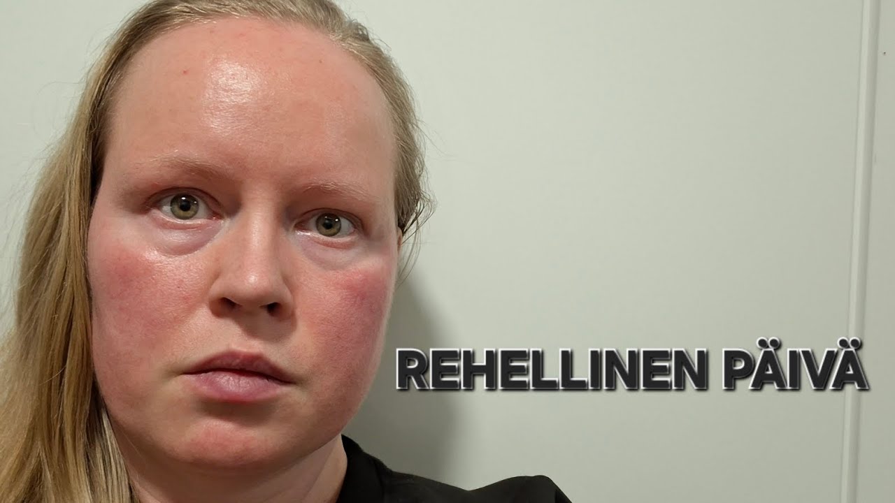 Rehellisesti... Olin lähellä luovuttaa - rehellinen tilanne elämäntapamuutoksesta
