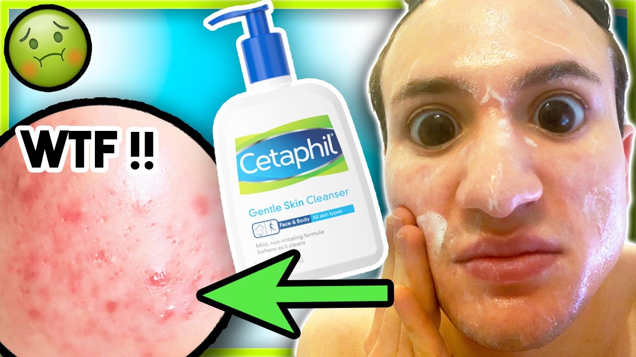 I tried Cetaphil GENTLE SKIN Cleanser for ONE WEEK! (it broke me out?!)