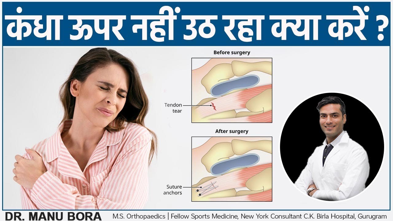 कंधा ऊपर नहीं उठ रहा क्या करें ? || Kandha Upar Nahi Ja Raha Kya Kare || Dr. Manu Bora