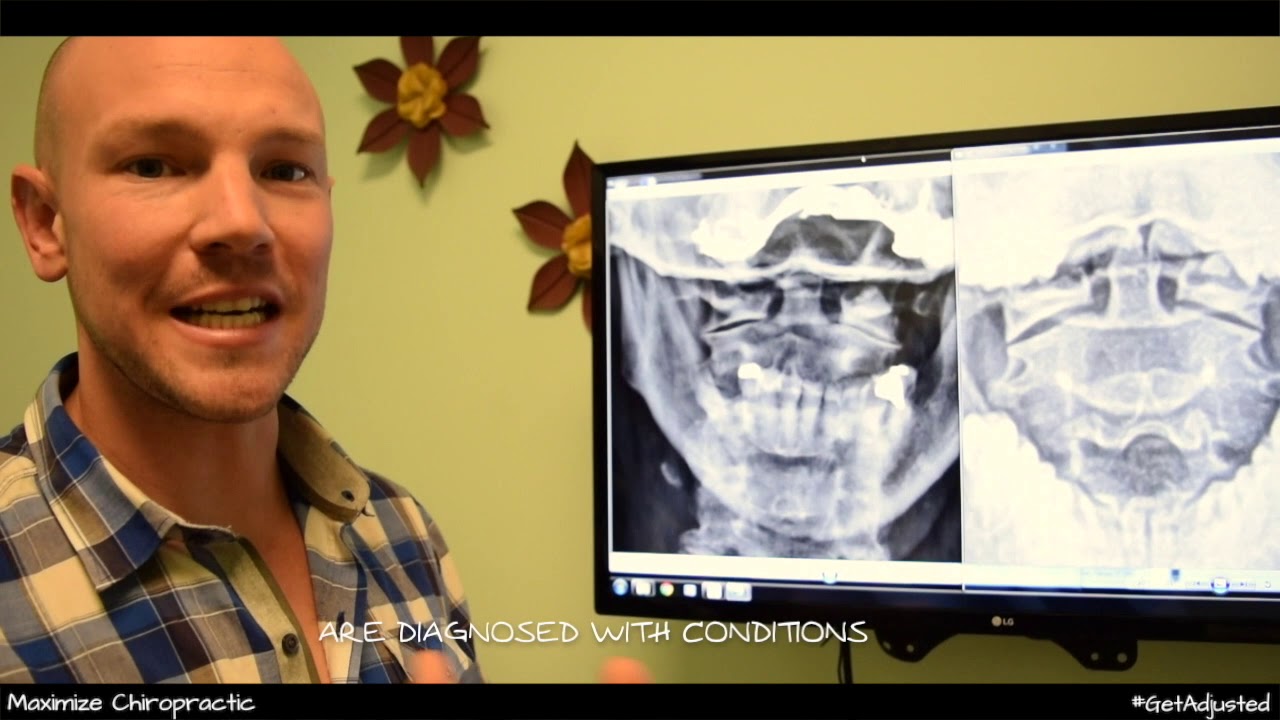 Vertigo - Clinical Review - Sacramento Chiropractor