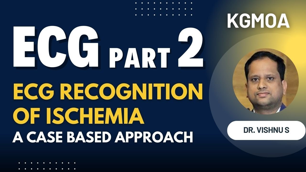 ECG Part II &ndash; ECG Recognition of Ischemia: A Case-Based Approach | KGMOA Webinar
