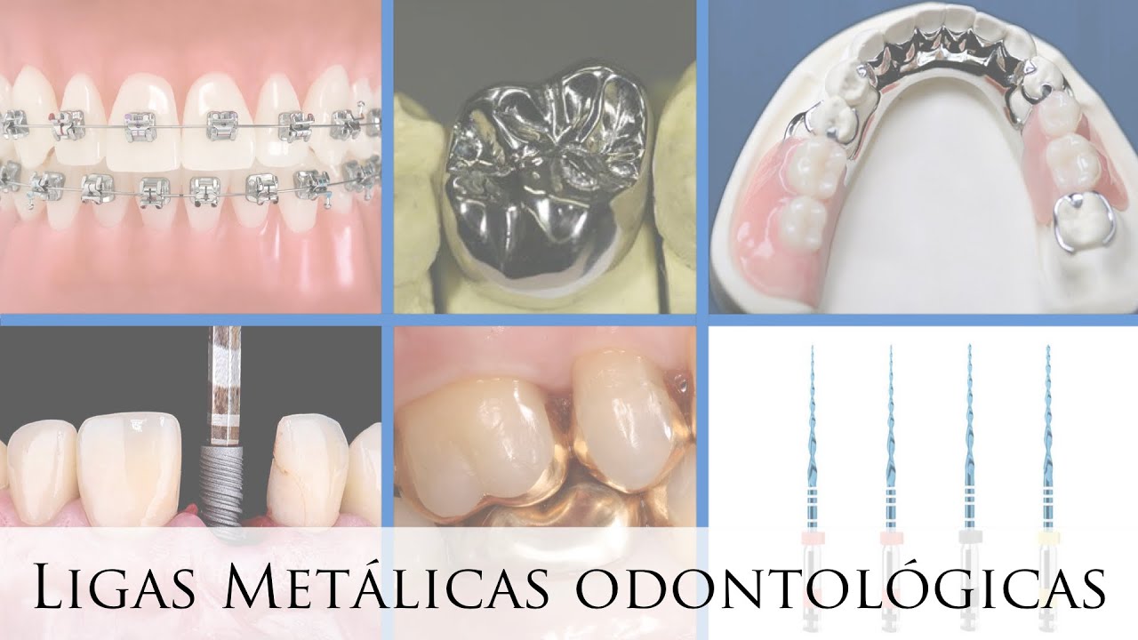 Ligas Metálicas Odontológicas