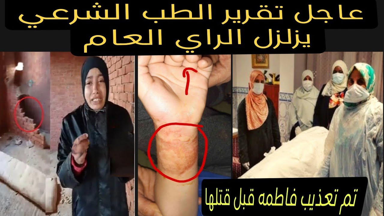 انفراد وحصري‼️ تقرير الطبي الشرعي اثبت كشف المستور في قضيه فاطمه عروسه بورسعيد