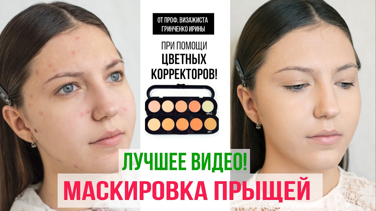 МАСКИРОВКА ПРЫЩЕЙ! ПРИ ПОМОЩИ ЦВЕТНЫХ КОРРЕКТОРОВ/ Гринченко Ирина