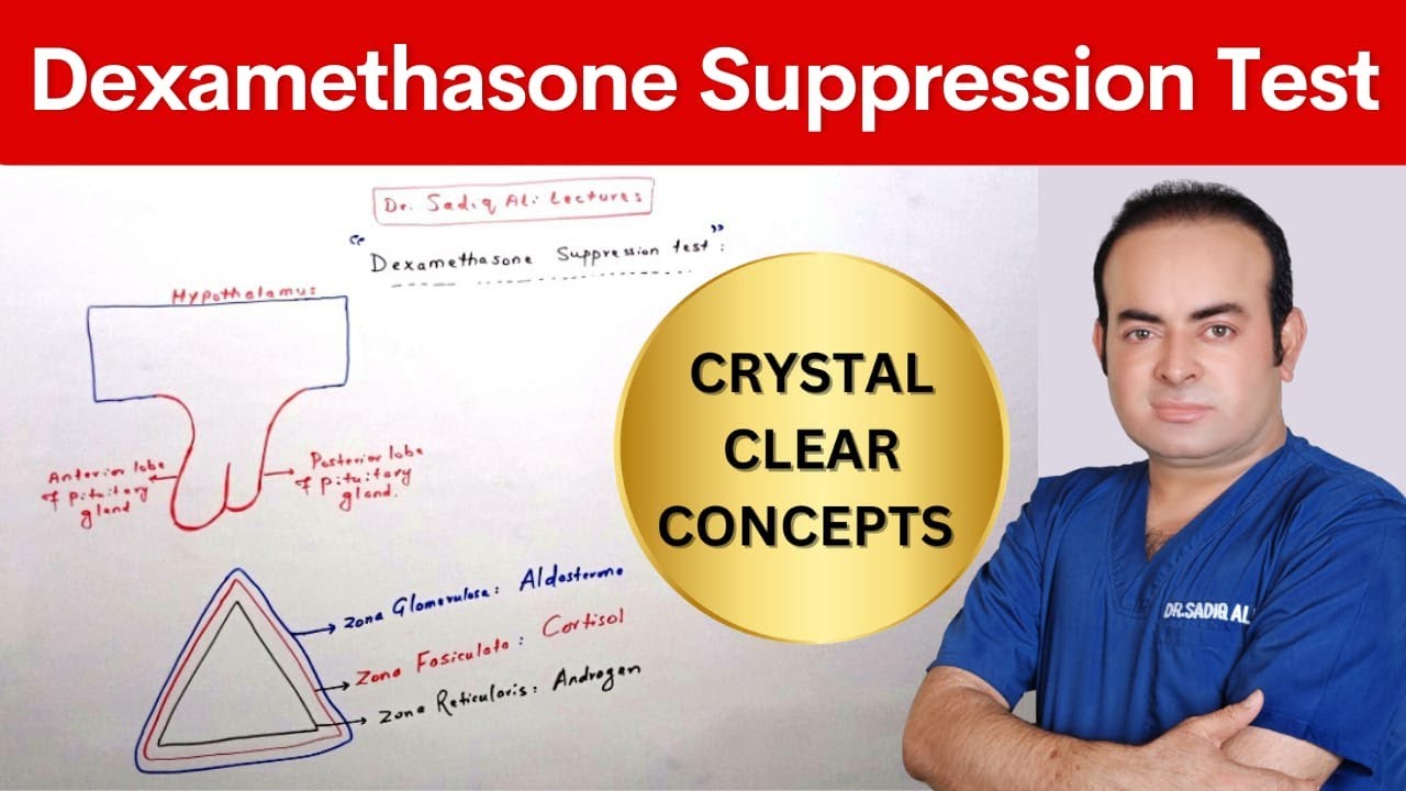 Dexamethasone Suppression Test | Dr. Sadiq Ali