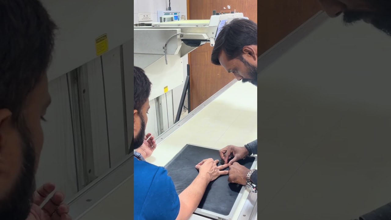 #Hand pain #x ray hand wrist -ap #finger #x ray  hand oblique #hand mri
