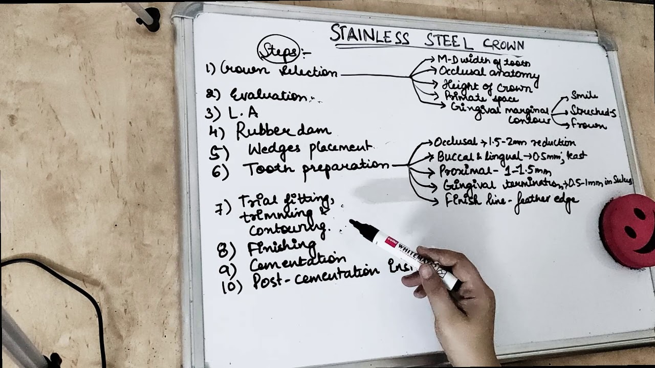 stainless steel crowns in pediatric dentistry