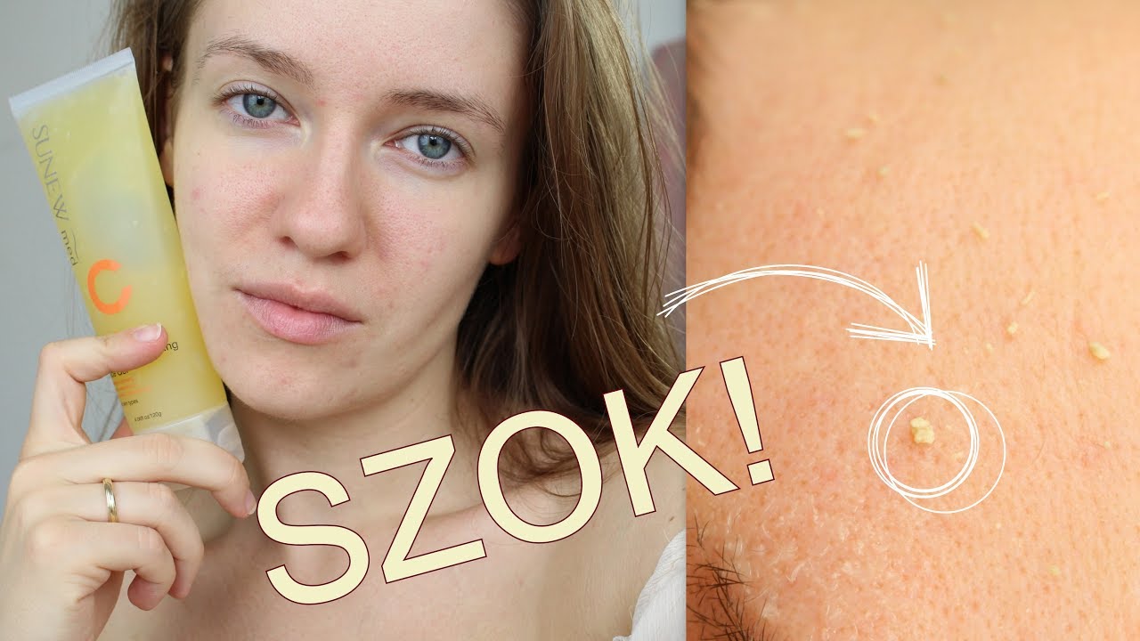 SUNEW MED- ŻEL ROZPUSZCZAJĄCY NASK&Oacute;REK - O CO CHODZI? CZY TO DZIAŁA?! || REDMYLIPSART