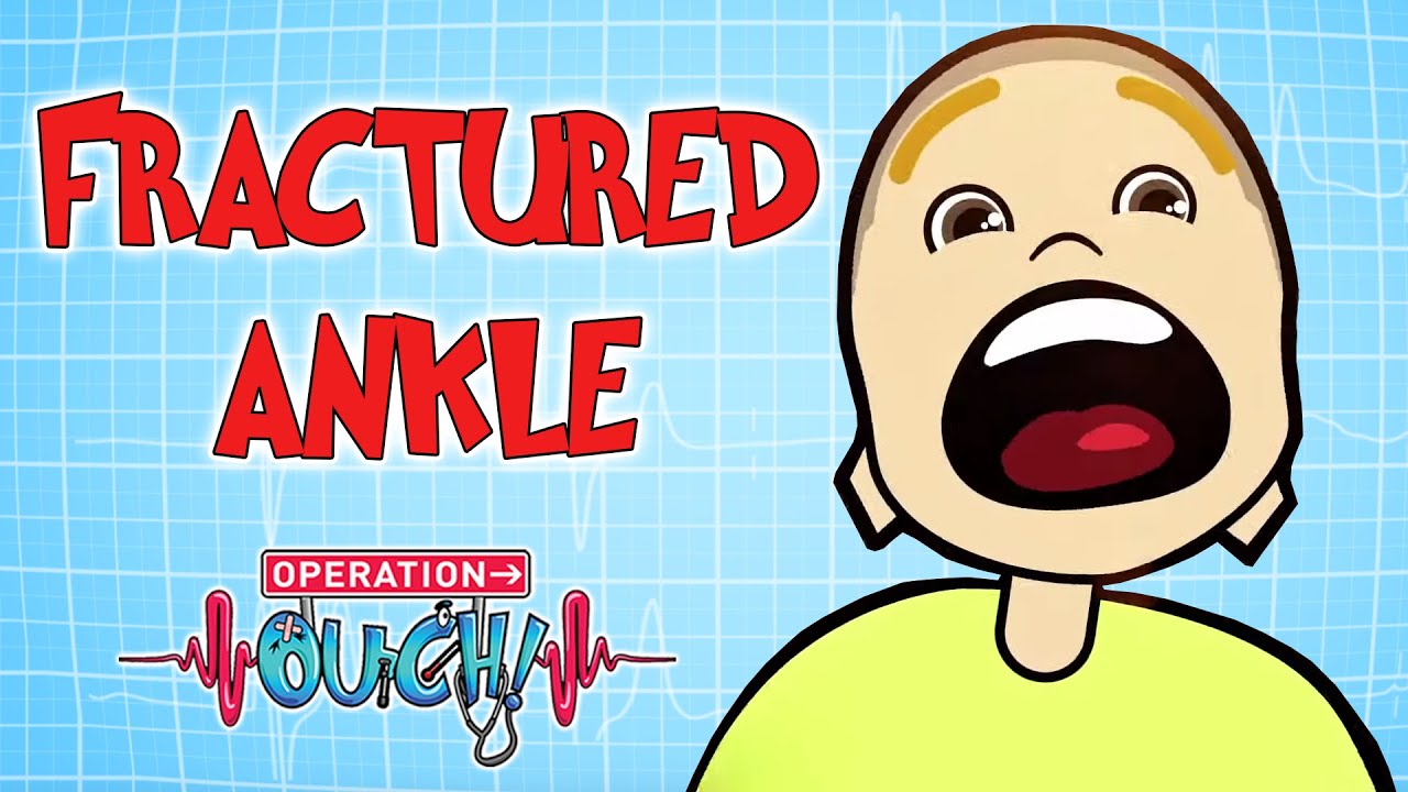 Why do You Need Crutches? | Operation Ouch