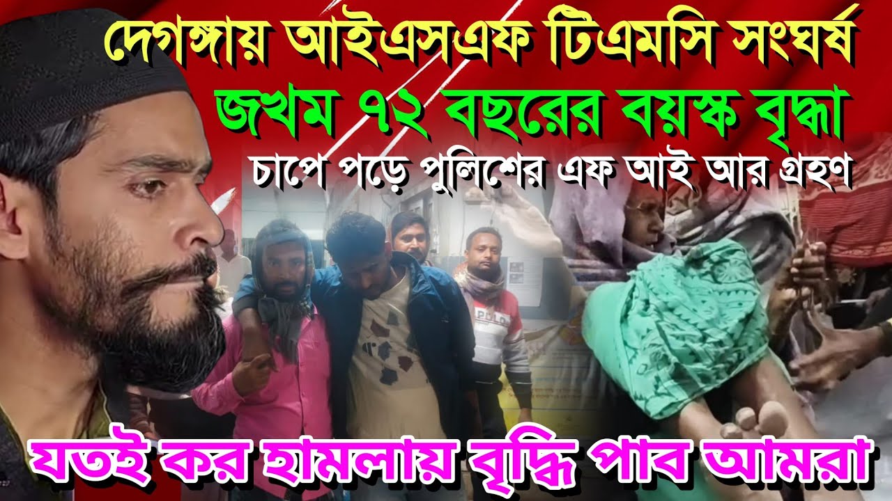 দেগঙ্গায় আইএসএফটিএমসি সংঘর্ষ ৭২বছর বৃদ্ধ মহিলা আক্রান্ত। তৃণমূলের কঙ্কাল দশা প্রকাশ্যে#deganga_news
