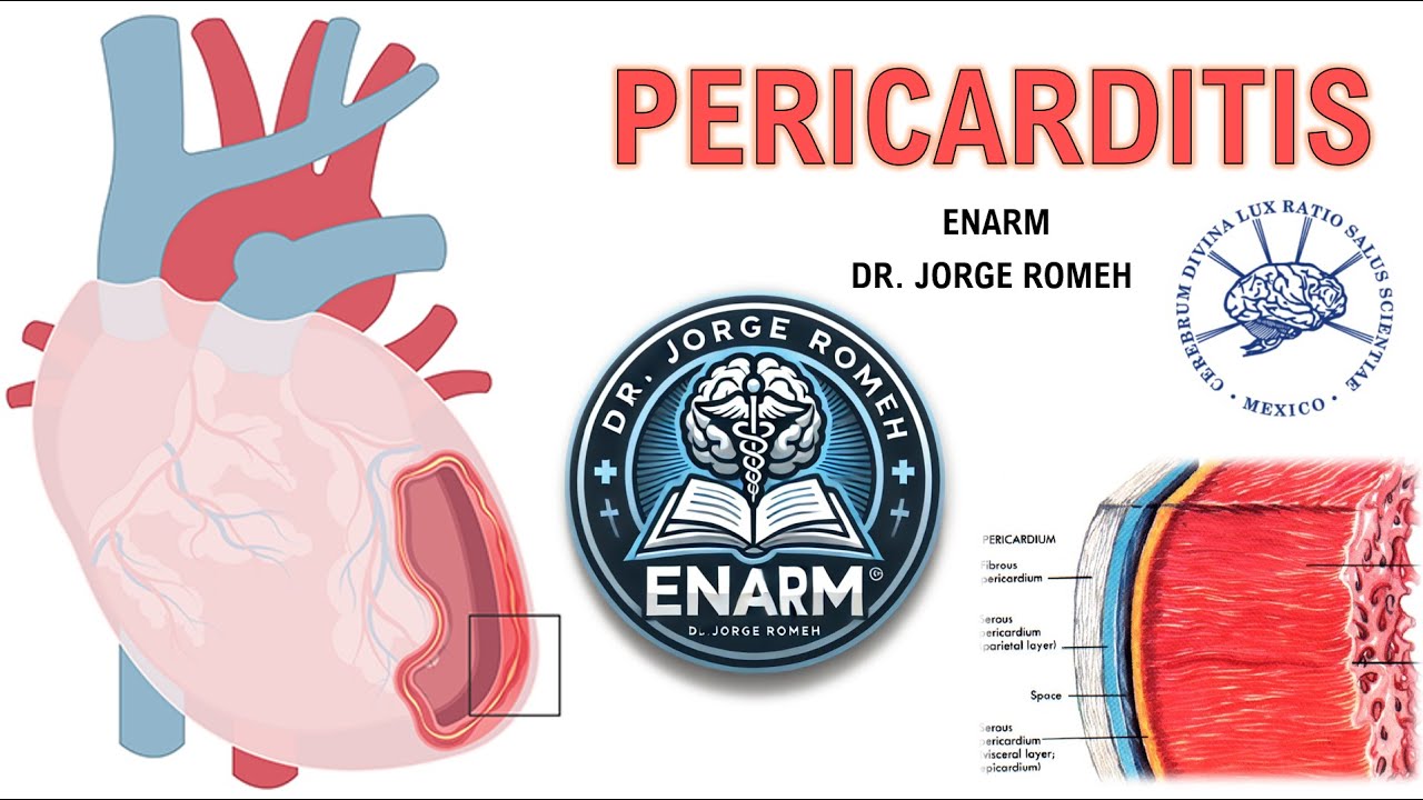 PERICARDITIS - ENARM - TODO LO QUE NECESITAS SABER