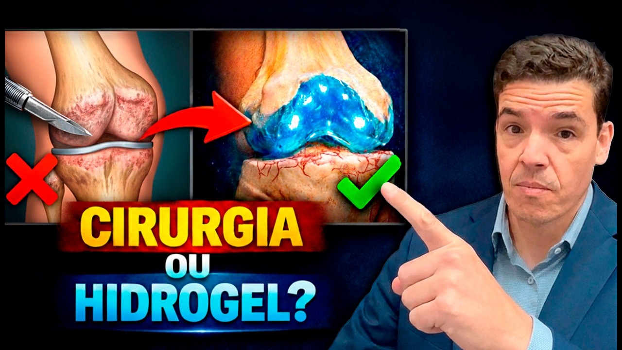 Hidrogel Bioativo pode mesmo EVITAR UMA CIRURGIA?