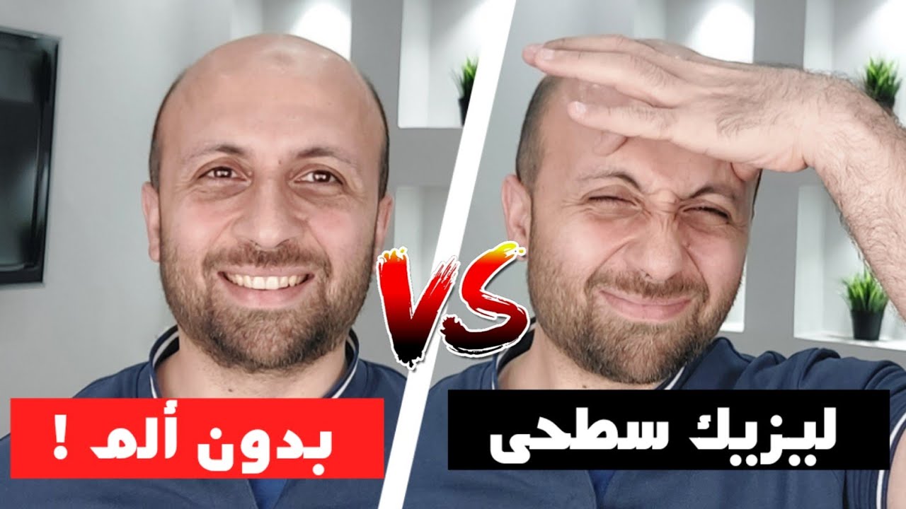 التحكم فى #ألم_العين بعد عملية #الليزيك_السطحى !!