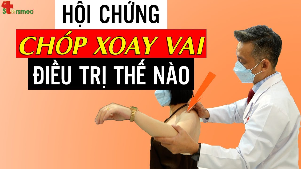 Hội chứng Chóp xoay vai - Điều trị thế nào? | Y học Thể thao Starsmec