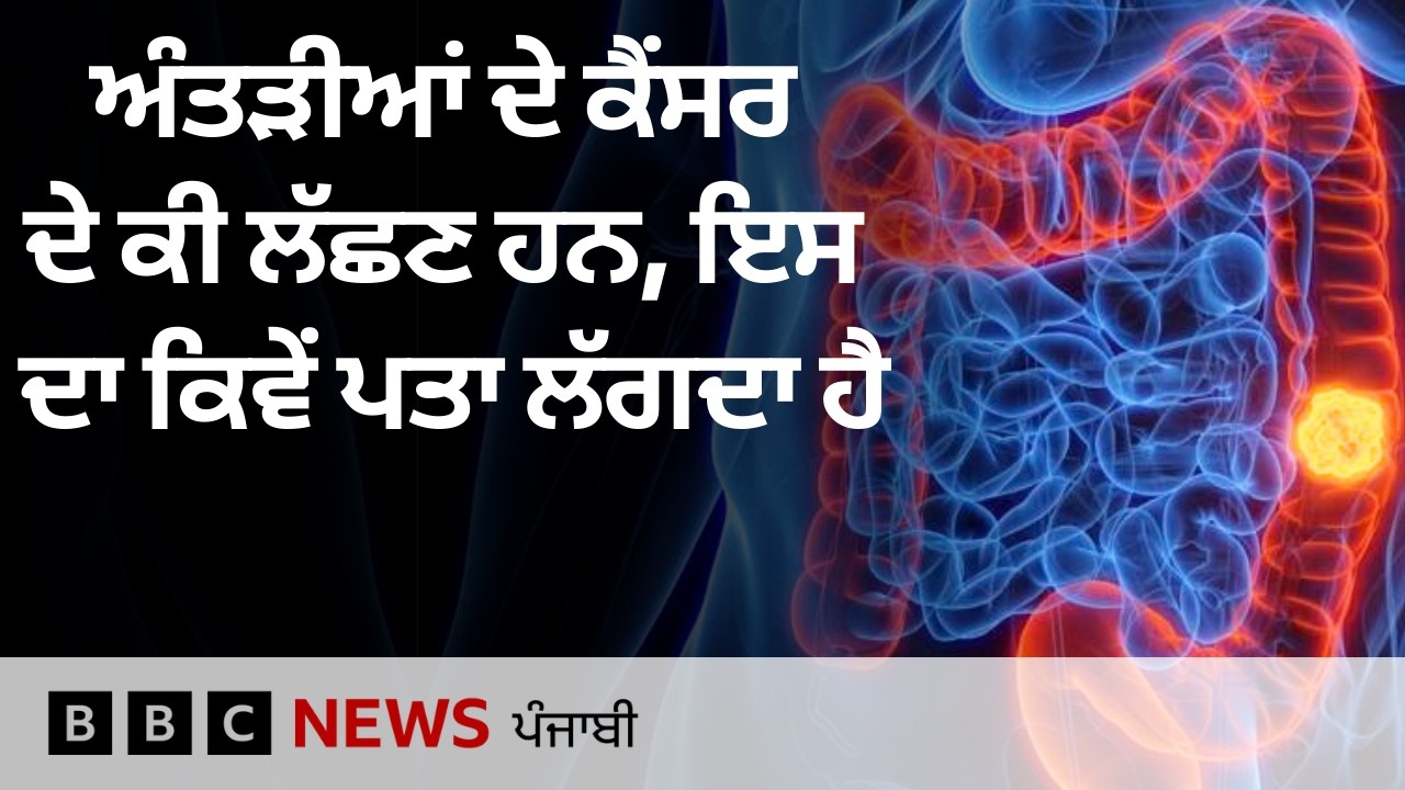 ਅੰਤੜੀਆਂ ਦੇ Cancer ਦਾ ਪਤਾ ਕਿਵੇਂ ਲਗਾਇਆ ਜਾਵੇ, ਜਿਸ ਦੇ ਨੌਜਵਾਨਾਂ ਵਿੱਚ ਕੇਸ ਵਧ ਰਹੇ ਹਨ| 𝐁𝐁𝐂 𝐏𝐔𝐍𝐉𝐀𝐁𝐈