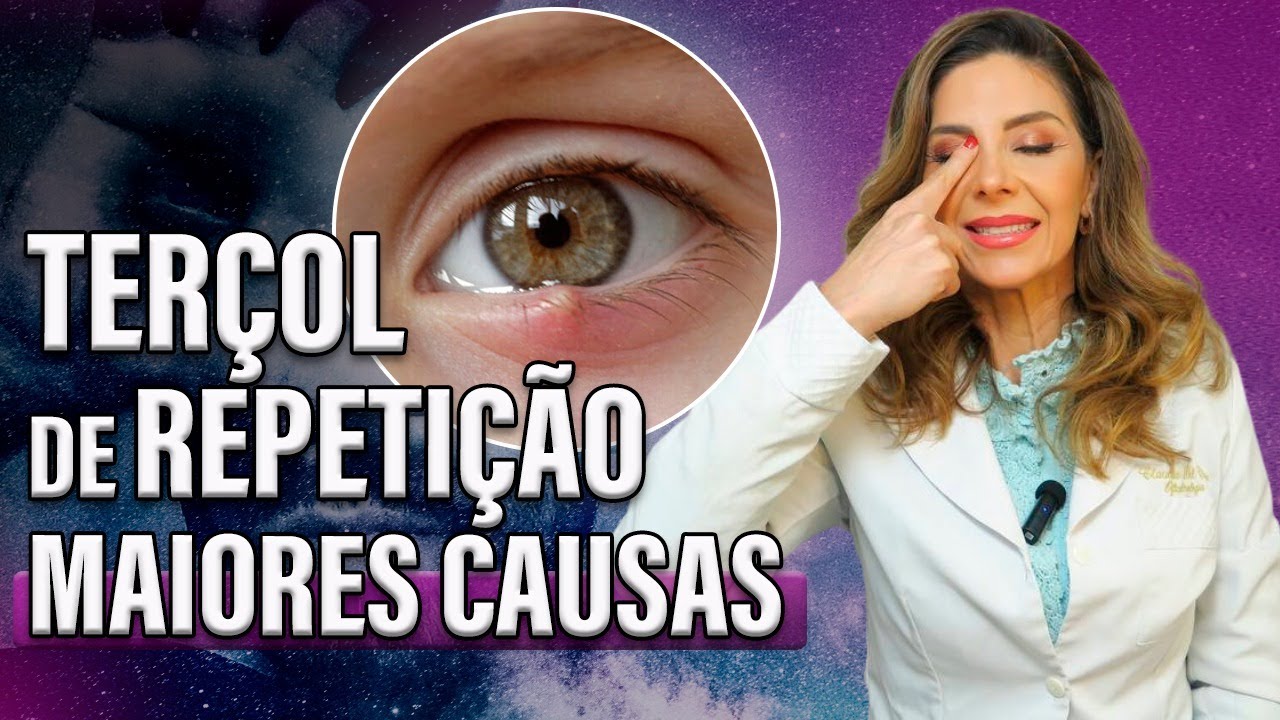 Ter&ccedil;ol de Repeti&ccedil;&atilde;o! Maiores Causas