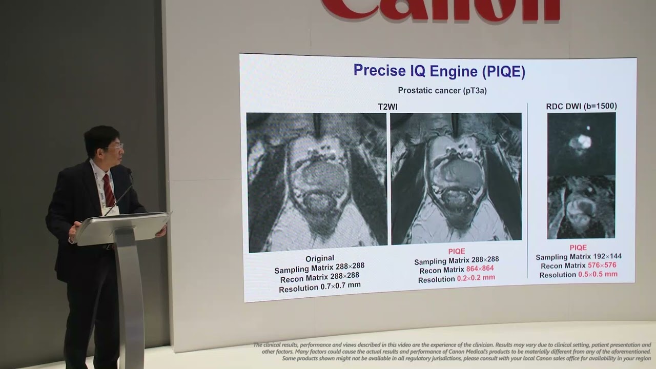 RSNA 2024 Presentation - Yoshiharu Ohno, MD, PhD