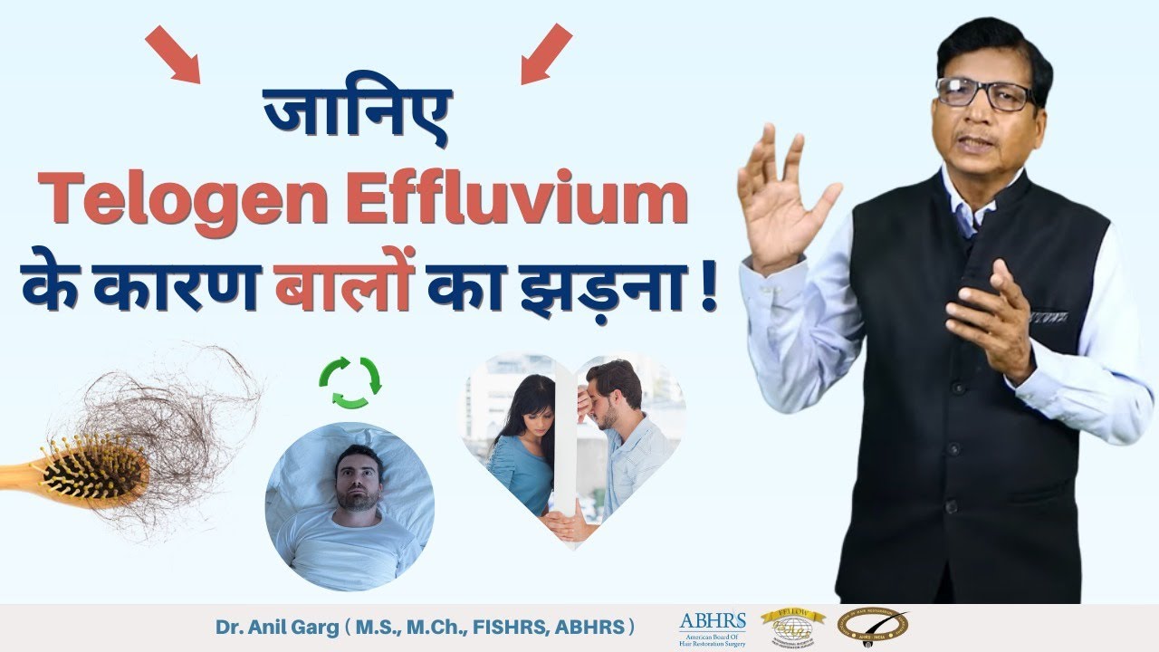 तेजी से बाल झड़ने का कारण |Telogen Effluvium Disorder |और उसका इलाज | गंजापन का इलाज |  by Dr Garg