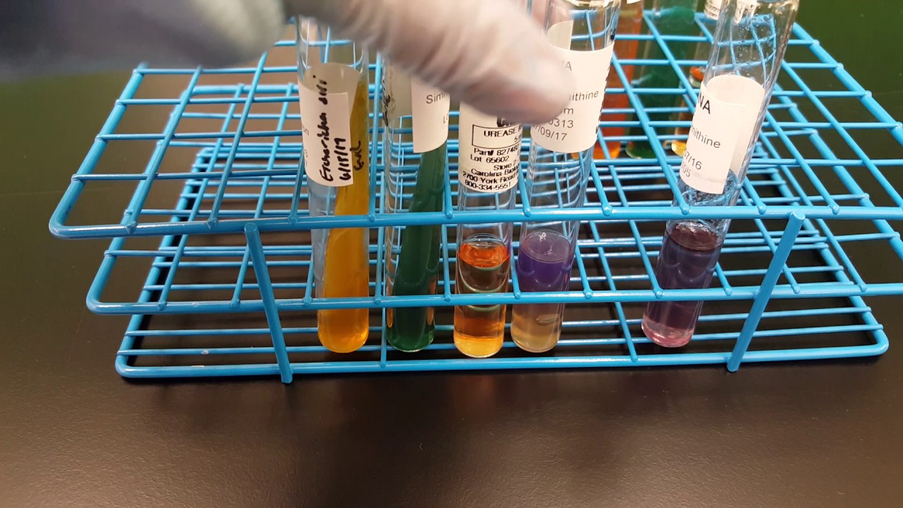Микробиология: Escherichia coli Интерпретация биохимических исследований