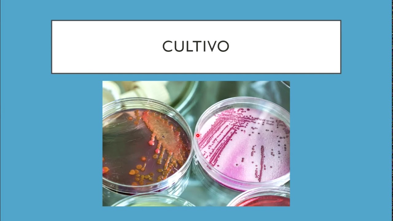 Diagnostico de laboratorio de Mycobacterium tuberculosis