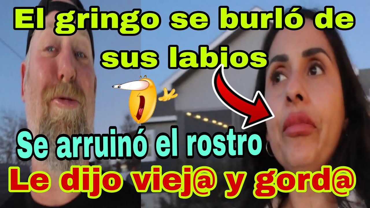 🚨El gring0 Se burló de sus labios💥😱Se arruinó el rostro😮Le dijo viej@ y g0rd@🫢🤦‍♀️