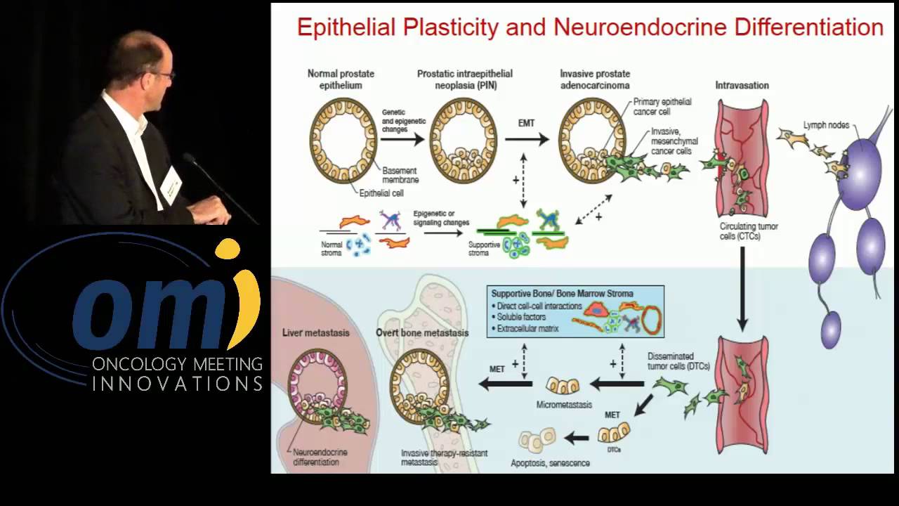 How do I approach NEPC? - Andrew J. Armstrong