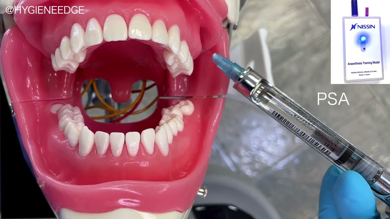 Injection Review with the Kilgore Conduction Anesthesia Model