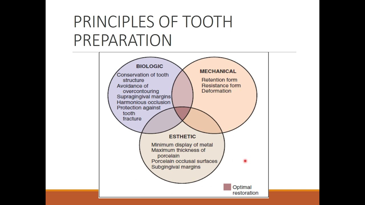 TOOTH PREPARATION FOR PORCELAIN FUSED METAL CERAMIC CROWN