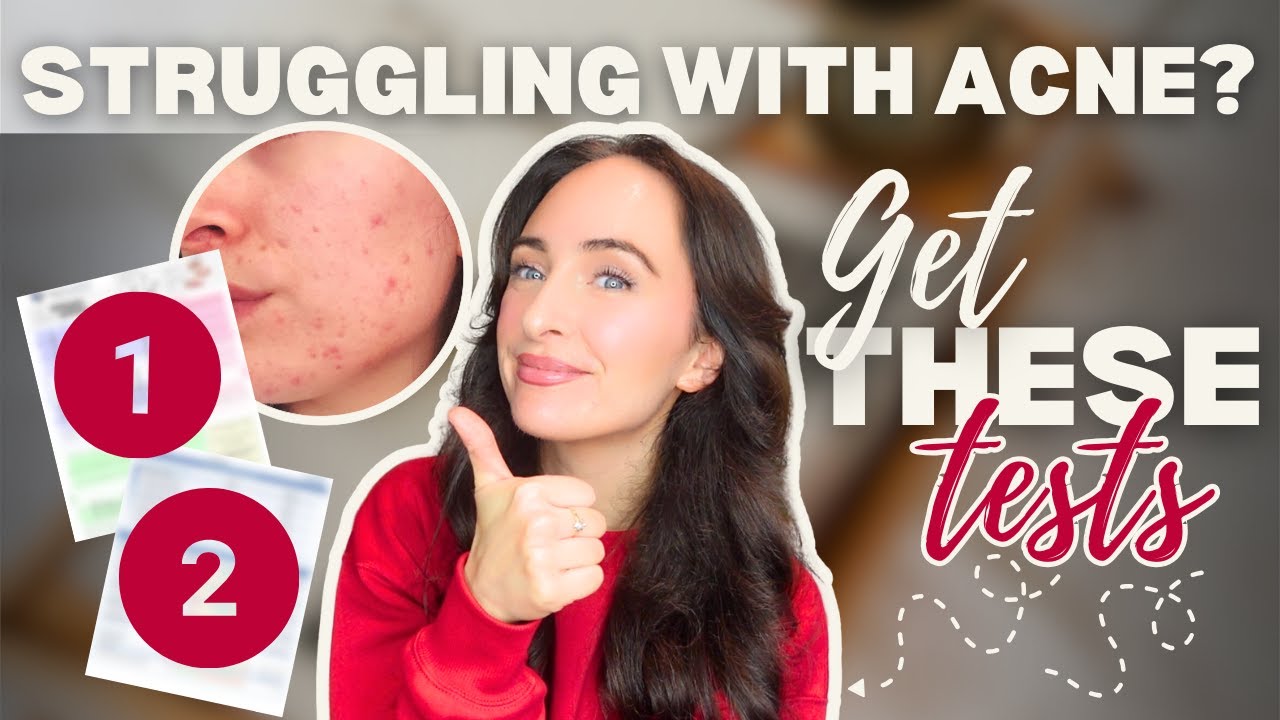 Struggling with Acne? Get these 2 Functional Tests!