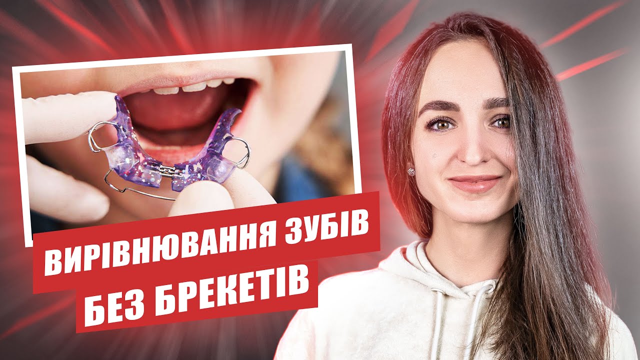 🇺🇦 Вирівнювання зубів без брекетів