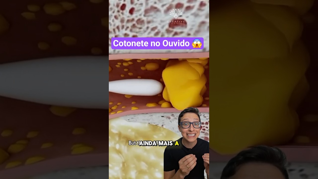 Cotonete no Ouvido 😱#medicina #medico #enfermagem #enfermeiro #enfermeira Retirando Cera do Ouvido