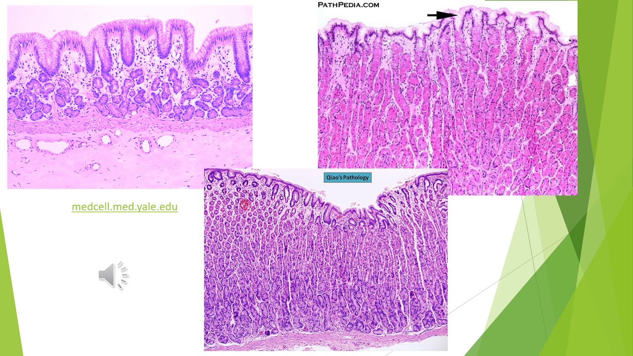 Gastric Pathology (1) | GI