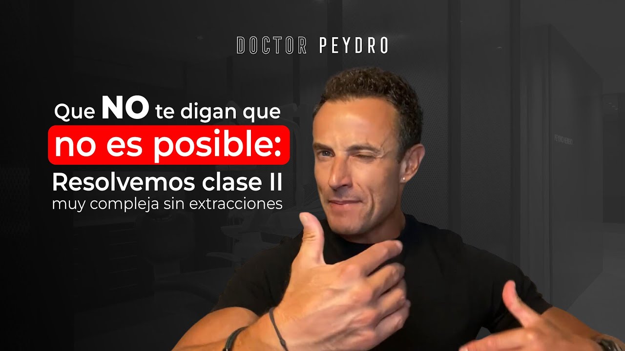 ⁉ ¿Es posible solucionar una mordida de clase II sólo con ortodoncia?