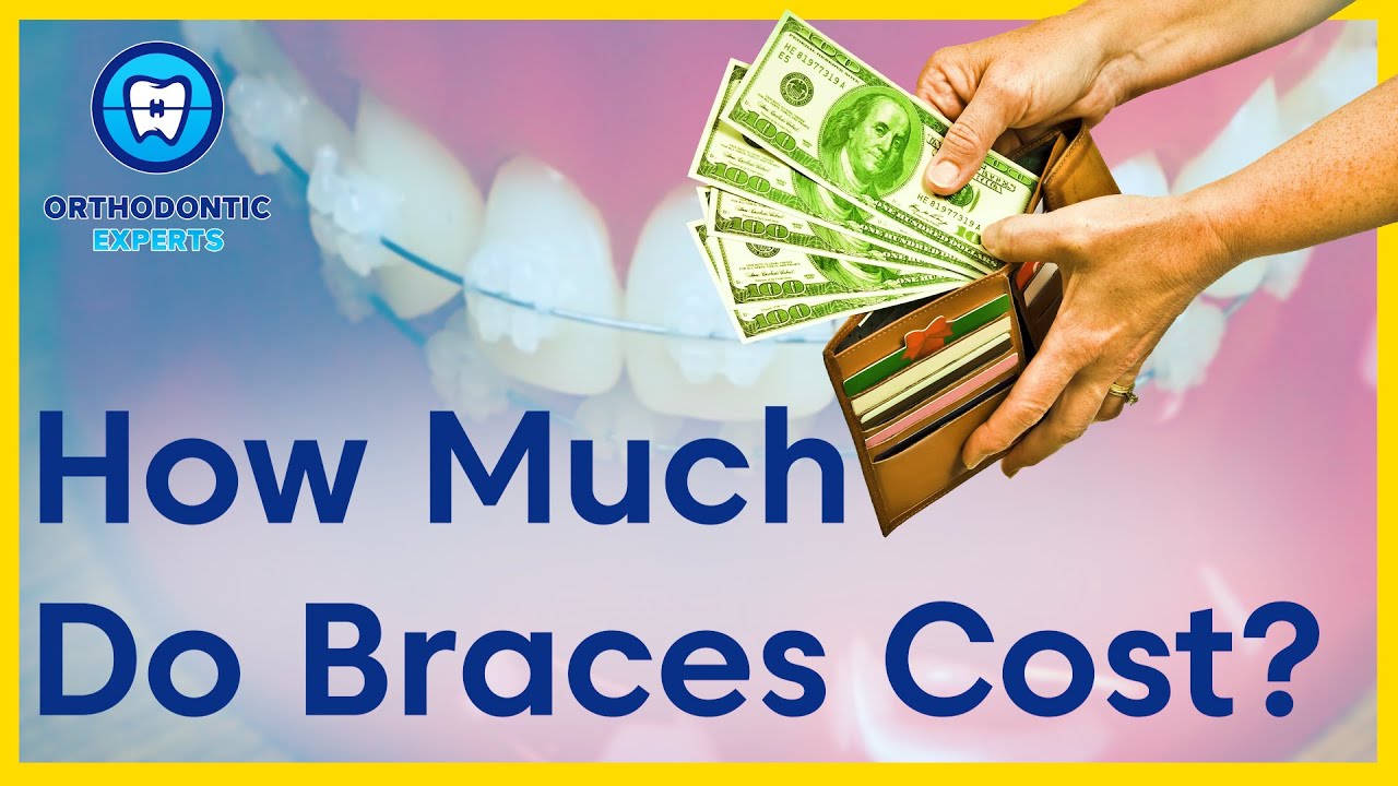 How Much Do Braces Cost?