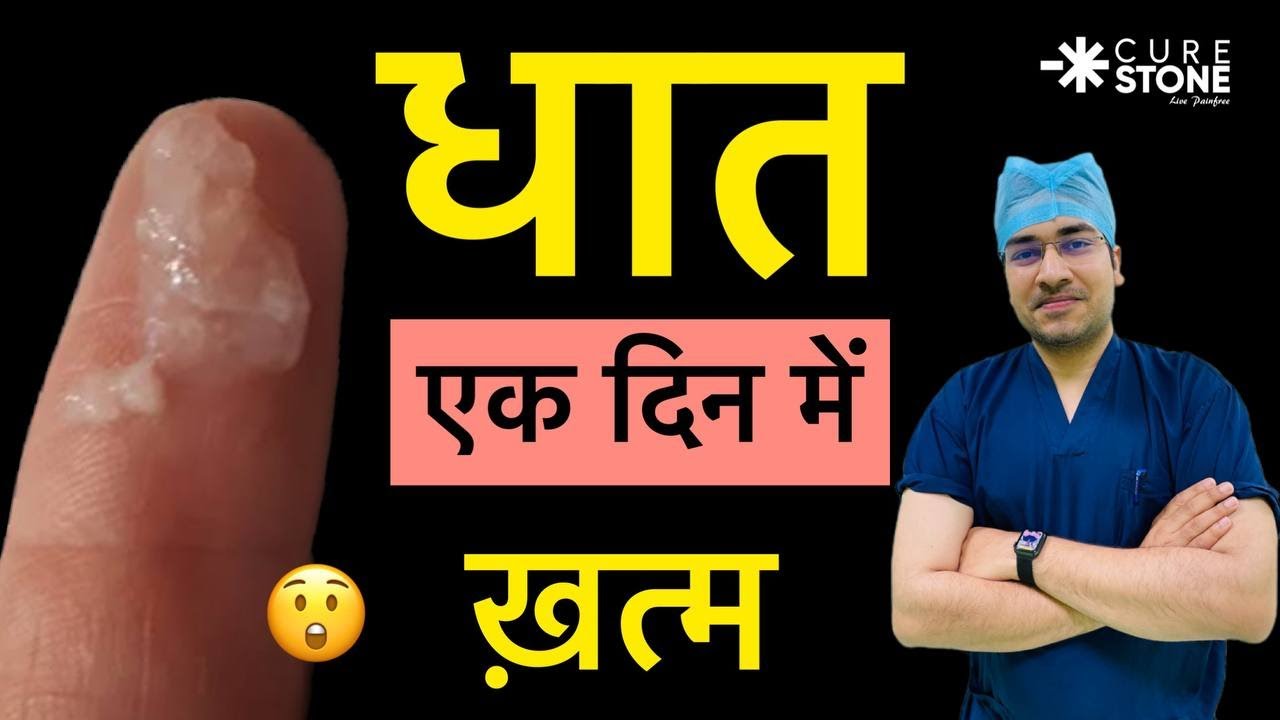 Dhaat(धात) एक दिन में ख़तम | Dhaat Syndrome in Hindi | धात रोग क्या और कैसे होता है? Part -2