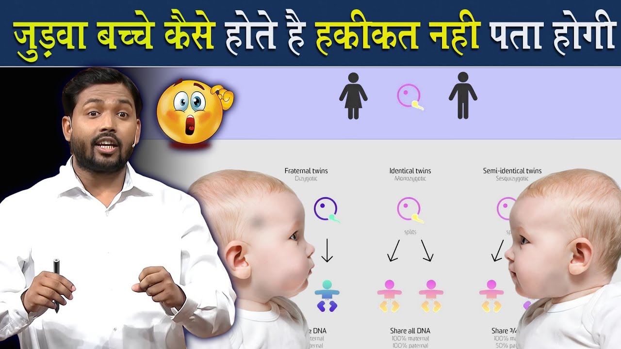 जुड़वा बच्चे कैसे होते है? जुड़ने बच्चे होने का पूरा साइंस समझिए