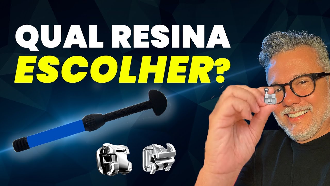 A melhor resina para colagem de bráquete!😁