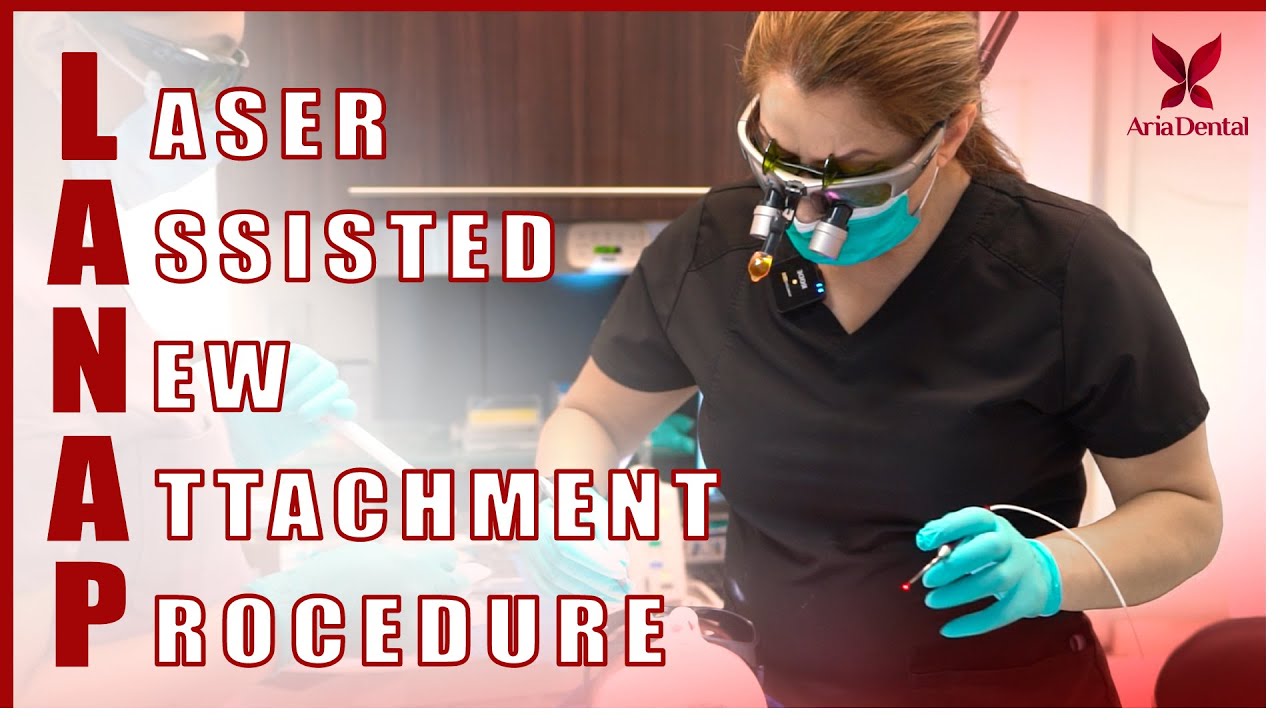 Benefits of LANAP - Alternative to Gum Surgery! | Aria Dental | Maryam Horiyat DDS.